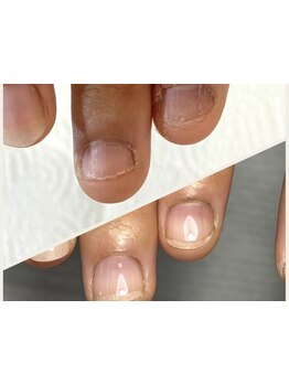 爪の悩みを解消できる（ケア含む）