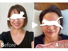 つばさ整体/【施術実績／石膏パック】