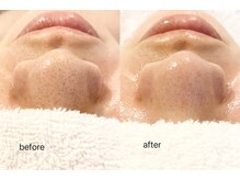 シエル(ciel)/before→after