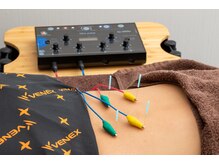 トップグレード鍼灸院(TOP GRADE鍼灸院)/電気パルス