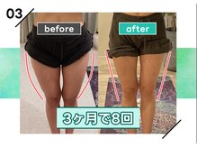 痩身革命 大宮店/ダイエットリンパマッサージ