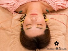 ネテマテ 表参道(netemate)/美容鍼灸/美容鍼/鍼灸