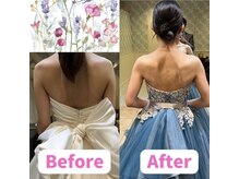 ボディキュア ブライダル美容整体 大阪梅田/巻き肩改善でドレス映え★/大阪