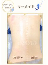 エキュロ 敦賀店(equro)/ブライダルメニュー（痩身）