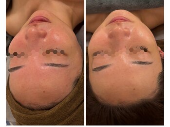 エリー(ERIE)/クリスティーナ イラストリアス