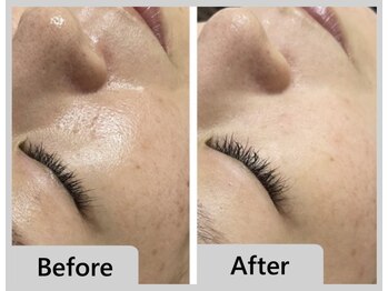 エマクラン(emmaclan)/