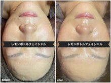 サロン フェリシア(salon Felicia)/50代女性Before/After