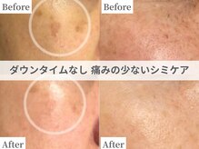 サロンドベルム(Salon de BELME)