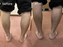 文京指圧/施術before／after
