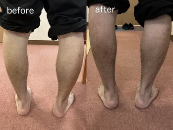 文京指圧/施術before/after