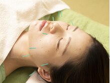 泰山はり灸院/美容鍼