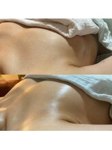 ララルアナ(Lara luana)/脇肉・背肉、実はお胸です。