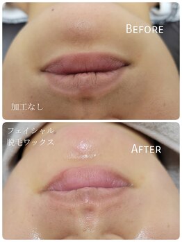 ルシアス(LUCIAZ)/フェイシャwax