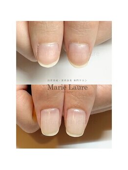 マリーロール 淀屋橋本店(Marie Laure)/深爪矯正/自爪育成/ネイルケア
