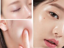 パルテール/毛穴/肌質改善/小顔/マッサージ