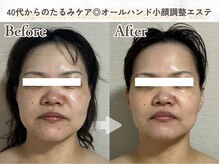 メイヴィ 四日市(Maivi)の雰囲気(土台から整えることで、ダウンタイムなく小顔リフトアップ◎)