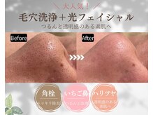 ラカ 川中島店(LaKa)の雰囲気（毛穴汚れをすっきり洗浄＋光フェイシャルで引締めケア）