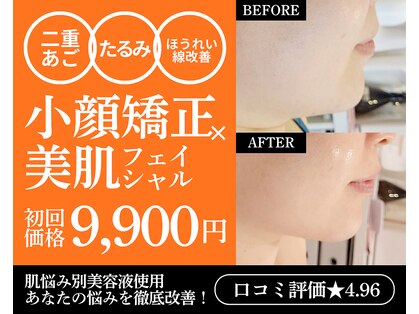 ハーボプラス(THE HEARBO plus)の写真