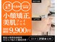 ハーボプラス(THE HEARBO plus)の写真