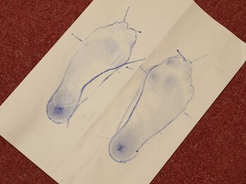 マゼンタ/フットプリント