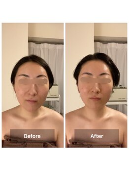 パピヨン(papillon)/ビフォーアフター