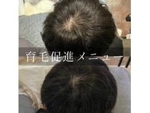 ピーディーエーサロン(PDA salon)の雰囲気（最新機械&オールハンドの育毛促進ドライヘッドプログラム）