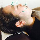 ハヌル鍼灸院(HANURU鍼灸院)