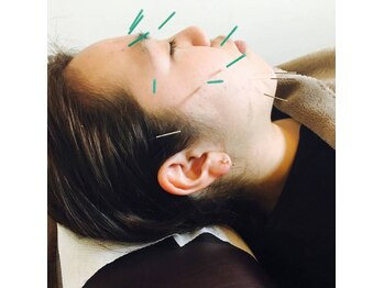 ハヌル鍼灸院(HANURU鍼灸院)