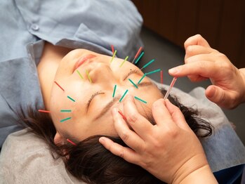 薮下整骨院 表参道院/美容鍼♪