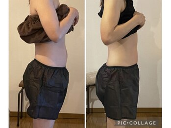 しあわせ腸研究所/before & after