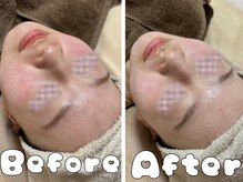 グラシア 倉敷店(Gracia)/お客様の施術事例