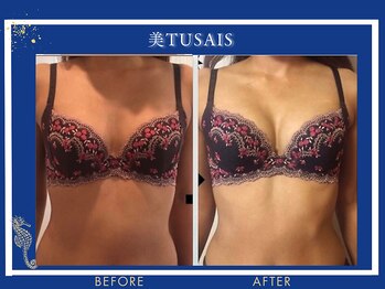 ビテュセスリー はなみずき店(美tusais3)/【美人バスト松山】バストアップ