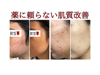 アールズ 南風原(R’s)/before/after