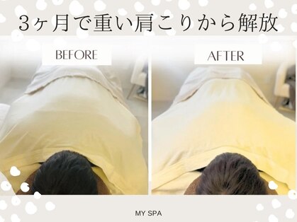 マイスパ(MY SPA)の写真