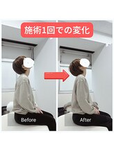 寿 天王寺院(KOTOBUKI)/天王寺/整体/肩こり/姿勢改善