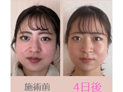 ノウ(nou)の写真