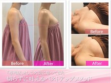 ロココ 安城店(Rococo)の雰囲気（Rococoオリジナルの施術でしっかりバストアップ！）