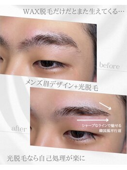 リノア(Linoa)/メンズ眉毛ビフォーアフター