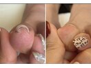 巻いた爪のケア補正 ¥5500～