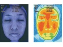≪肌質検査＆美肌のプロによるカウンセリング≫