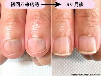 カピリナ(Ka Pilina)/最強のネイルケア