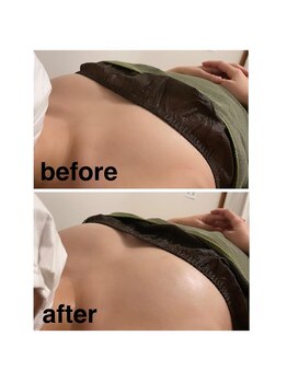 コティーバイホイヤ(Cotty by HOIYA)/バストアップケア