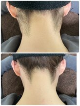 エン(en.)/BeforeAfter写真49