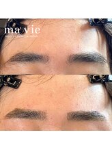 マヴィ 恵比寿 広尾店(ma vie)/ビフォーアフター