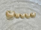 持ち込みデザインフット