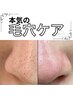 No. 1【長年の黒ずみ毛穴改善コース90分】毛穴エクストラクション＋美白ケア