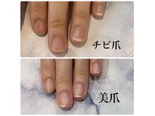 爪のコンプレックスを美爪へ導くプログラムが充実。