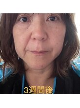 セントセシリア/GUINOT　VARの効果！3週間後