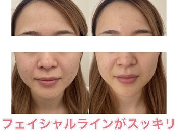 サクラ(SAKURA)/20代にはエアバリが大人気◎