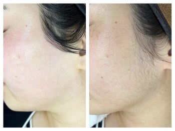 ヴェリー(Very)/お顔全体ワックス